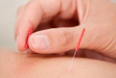 Ce nu stiai despre acupunctura: cum tratezi o boala cu un varf de ac