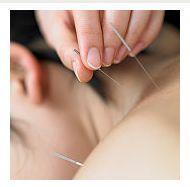 Afectiuni din sfera ORL si tratamentul lor prin acupunctura