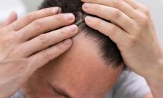 Alopecia de tractiune - cand poate fi necesar implantul de par?