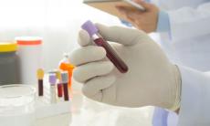 Analize de sange utilizate in patologia hepatica