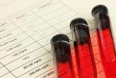 7 lucruri pe care medicul nu vi le explica despre analizele de sange