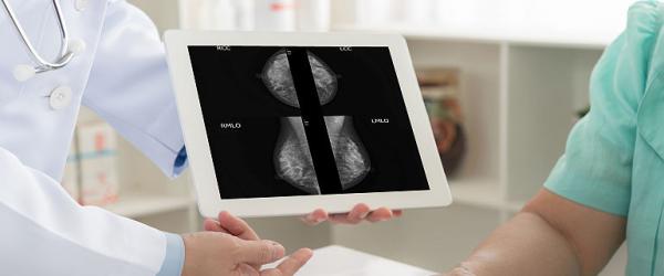 Cauze care pot determina anomalii ale sanilor