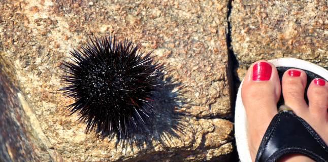 Simptomele si tratamentul intepaturii de arici de mare