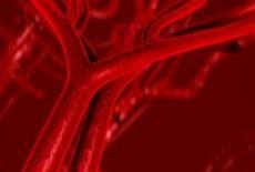 Cum tratam arteriopatia periferica cronica?