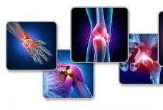 tratamentul bolilor inflamatorii ale articulațiilor osteoartrita de gradul 2 a mainii
