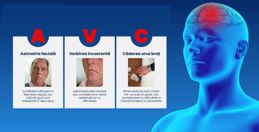 Cum recunosti rapid un accident vascular cerebral. Cele trei semne care salveaza vieti