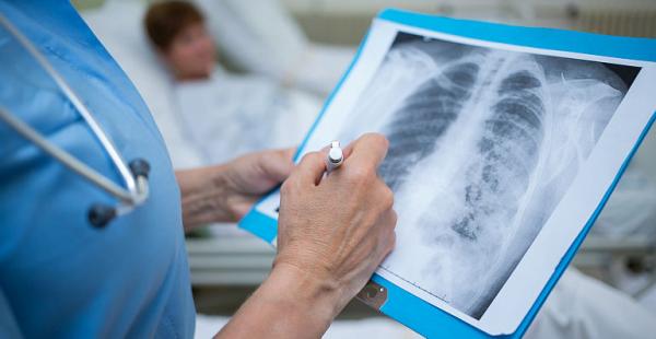 Boala legionarilor - o forma rara si severa de pneumonie