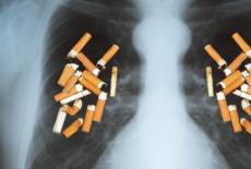 Cancerul pulmonar - cum poti recunoaste din timp simptomele?