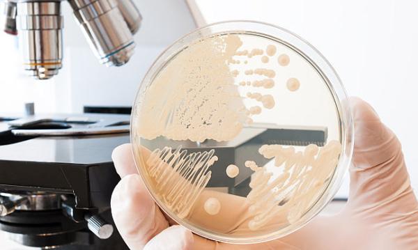 Cum se trateaza corect candidoza si de ce reapare?