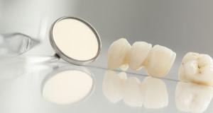 Se pot vindeca cariile dentare de la sine?