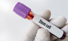 Intrebari esentiale pe care sa i le adresezi medicului despre celulele stem