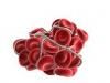 Pericolele formarii cheagurilor in vasele de sange