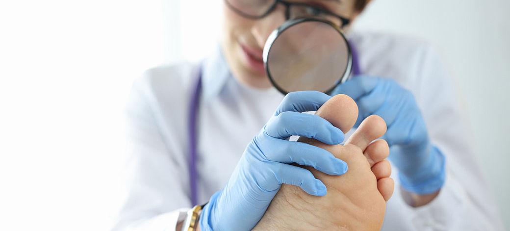 Ciuperca unghiei: Cum iti dai seama ca e timpul sa mergi la medic