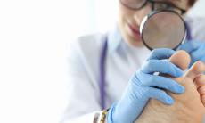 Ciuperca unghiei: Cum iti dai seama ca e timpul sa mergi la medic