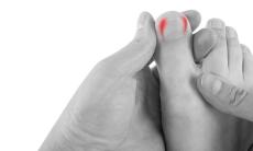 Pantofii tai pot favoriza ciuperca unghiei? Sfaturi esentiale pentru alegerea incaltamintei