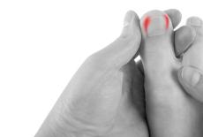 Pantofii tai pot favoriza ciuperca unghiei? Sfaturi esentiale pentru alegerea incaltamintei