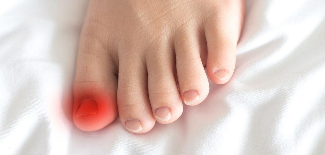 Ce se intampla daca ignori micoza unghiei? Riscuri ascunse pentru sanatate
