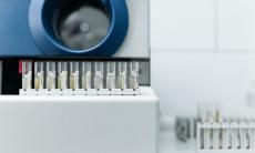 Colesterol HDL vs LDL: diferente, valori normale si cum le echilibrezi