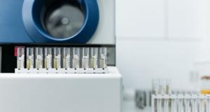 Colesterol HDL vs LDL: diferente, valori normale si cum le echilibrezi