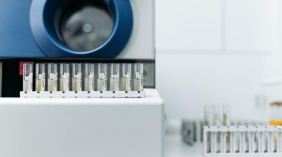 Colesterol HDL vs LDL: diferente, valori normale si cum le echilibrezi
