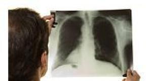 Bolile Pulmonare – subiect de dezbatere la Conferinta Nationala a Pacientilor, editia a II a