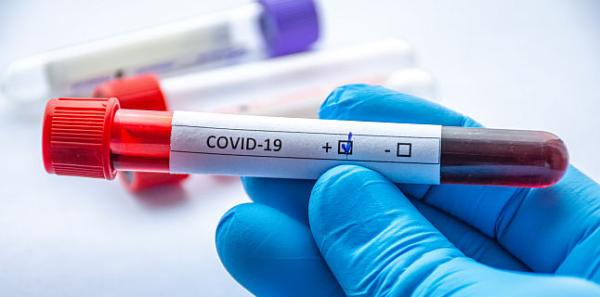 Primul caz de reinfectare cu COVID-19, la 4 luni de la prima contaminare