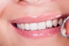 Cauze ale modificarii de culoare a dintilor