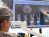 Implantul dentar pas cu pas: ce conteaza pentru un rezultat stabil si functional pe termen lung