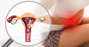 Endometrioza la adolescente