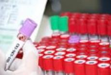Analize de sange pentru depistarea cancerului