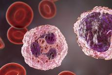 Semnele si simptomele generale intalnite in fibromatoza