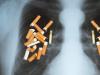 Legatura dintre fumat si riscul aparitiei cancerului