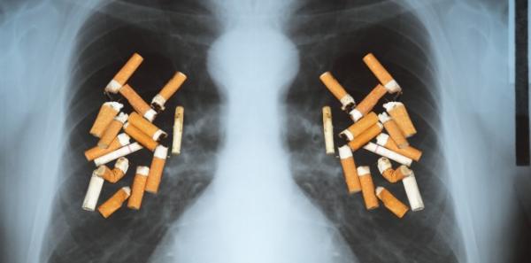 Legatura dintre fumat si riscul aparitiei cancerului
