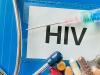 Caracteristicile bolii SIDA si ale persoanelor seropozitive