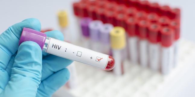 Simptomele infectiei cu HIV la femei