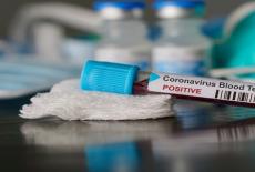 681 cazuri de coronavirus in ultimele 24 de ore, din 8.570 teste. Scenariu pesimist: In septembrie am putea ajunge la peste 1 milion de infectari