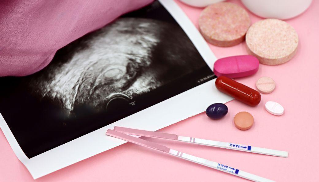 De ce dureaza atat de mult diagnosticarea endometriozei?