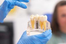  Implantul dentar cu incarcare imediata: cand este posibil si care sunt beneficiile reale