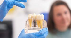  Implantul dentar cu incarcare imediata: cand este posibil si care sunt beneficiile reale