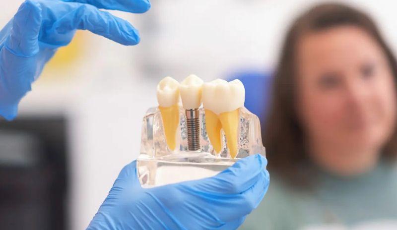  Implantul dentar cu incarcare imediata: cand este posibil si care sunt beneficiile reale