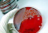 Infectiile bacteriene