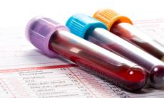 Leucemia limfatica cronica