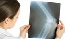 Importanta preventiei - tema centrala a conferintei de presa dedicate Zilei Internationale a Osteoporozei