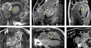 Cardio-RM-ul, cea mai complexa investigatie dedicata inimii si aplicatiile sale pentru pacientii din Romania