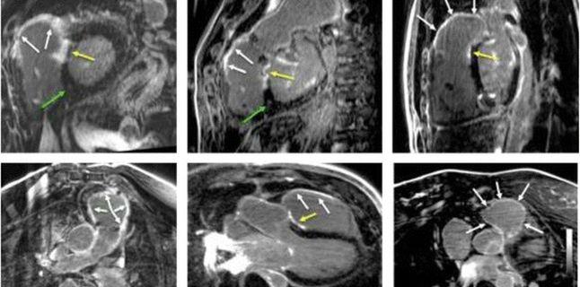 Cardio-RM-ul, cea mai complexa investigatie dedicata inimii si aplicatiile sale pentru pacientii din Romania