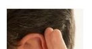 Cauze ale pierderii auzului