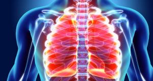 Cum se poate ajunge la plaman perforat (pneumotorax)?