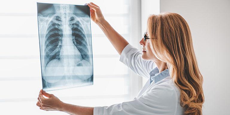 Cand se realizeaza transplantul pulmonar?