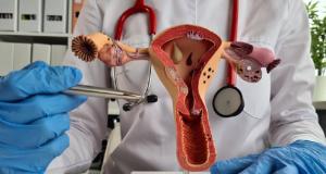 De ce este esentiala indepartarea polipilor uterini, chiar si fara simptome?