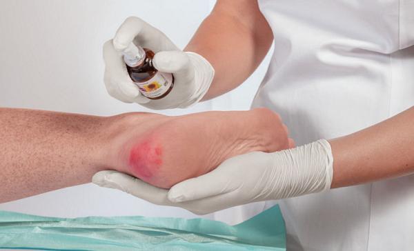 Preventia si tratamentul escarelor – O perspectiva moderna asupra managementului ranilor de decubit